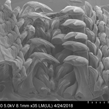 Imagen de microscopio electrónico de la rádula del quitón con sus dientes