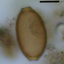 Huevo microscópico de tenia de pescado encontrado en coprolito de perro. La barra de escala negra representa 20 micrómetros