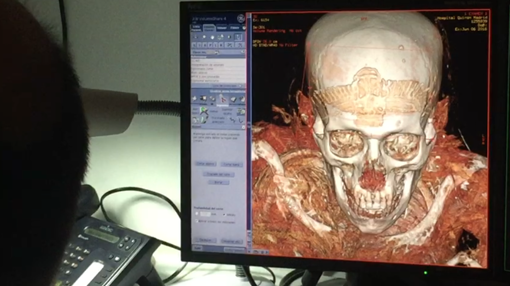 La primera sorpresa de la noche fue la aparición de una diadema de la que no se tenía noticia en la frente de Nespamedu