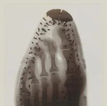 Foto de rayos X tomada por Ernest Payne en 1896