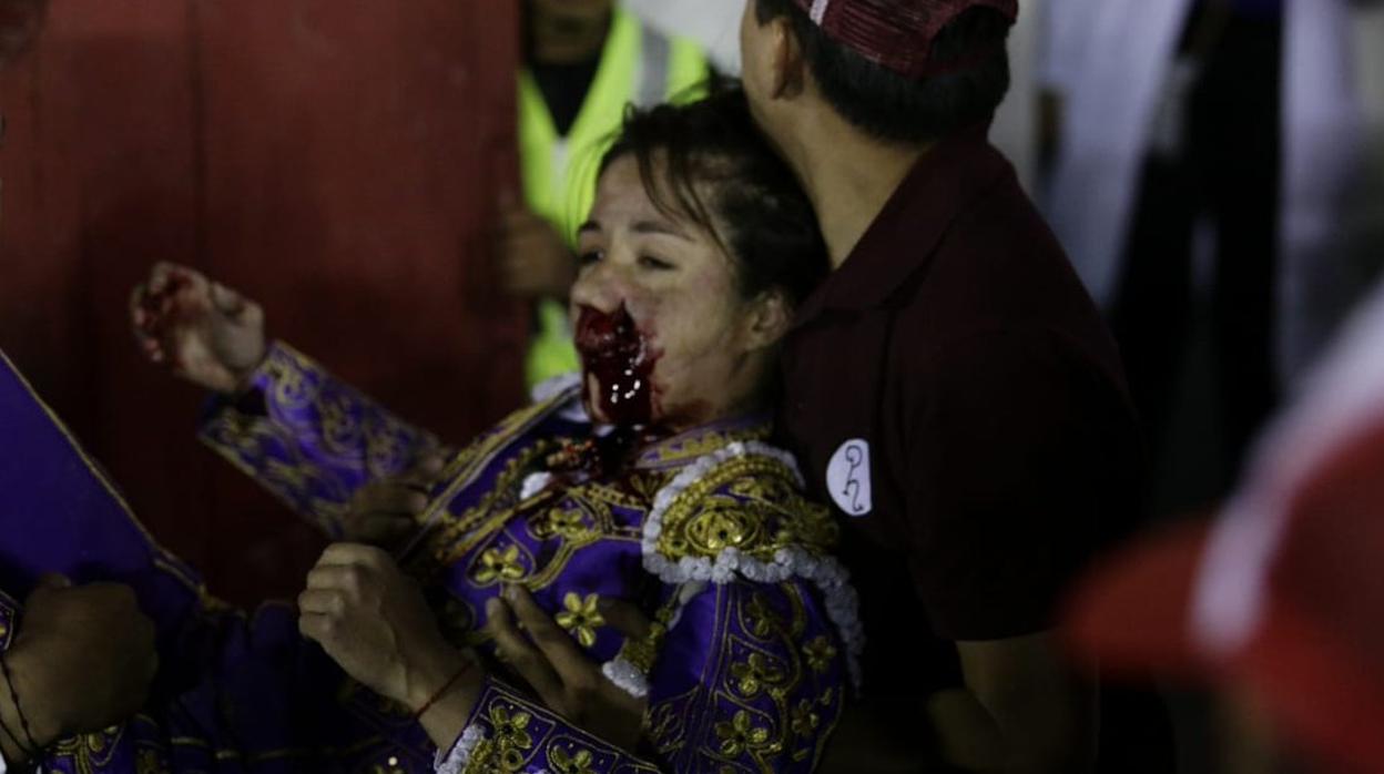 Hilda Tenorio, con la cara ensangrentada tras la cornada en la boca