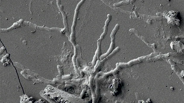 Increíble descubrimiento en Pompeya de neuronas en el cerebro vitrificado de una víctima del Vesubio