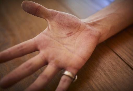 Lo que queda del accidente: una cicatriz para no olvidar