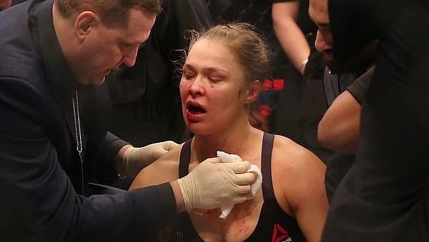 Ronda Rousey: «Pasarán meses antes de que pueda comer una manzana»