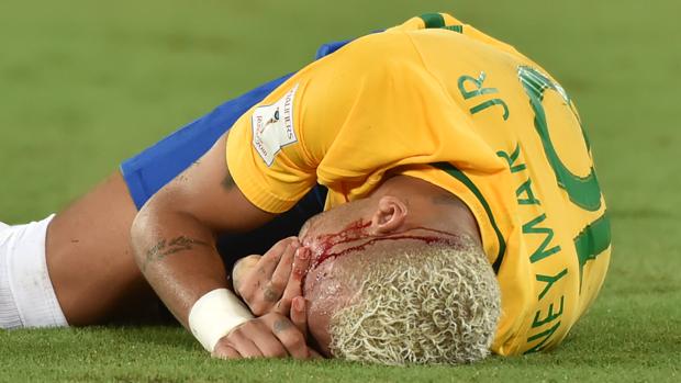 Neymar, ensangrentado, tras recibir el codazo de Duk