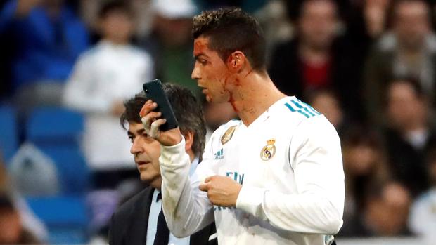 Cristiano pidió un móvil para ver cómo sangraba su brecha