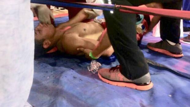 Muere el venezolano Yeison Cohen tras pasar dos semanas en coma