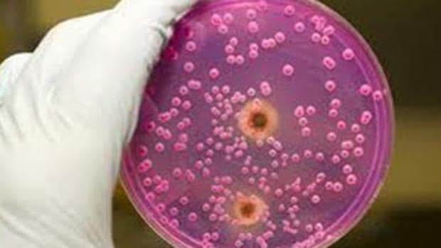 Bacterias de salmonela en un cultivo de laboratorio