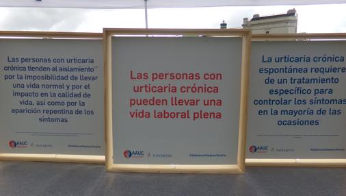 Los mitos de la urticaria crónica, un «estigma» que ataca a más de 300.000 personas en España