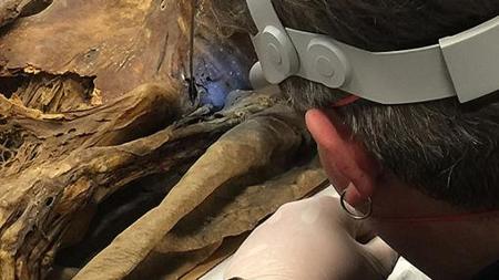 Un científico analizando una momia canaria