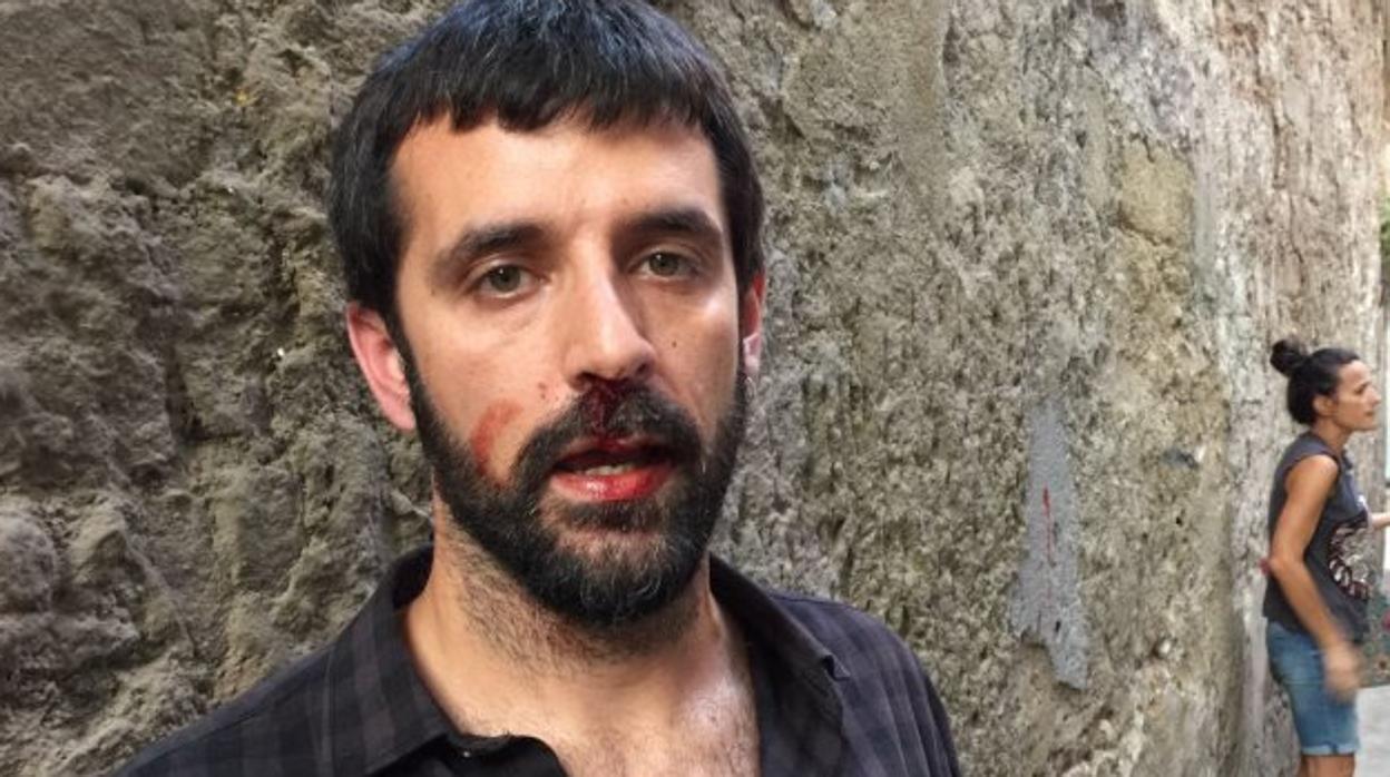 El fotoperiodista Jordi Borràs, tras ser agredido