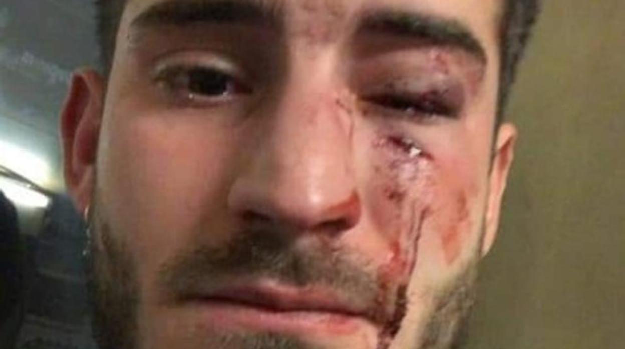 El joven ha compartido en redes sociales las heridas que le ha causado la brutal agresión