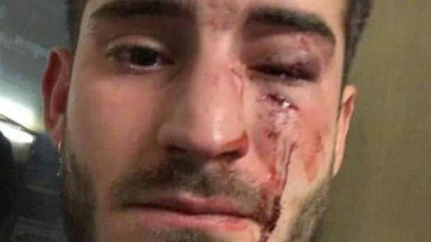 Detenidas dos personas por una agresión homófoba en el metro de Barcelona