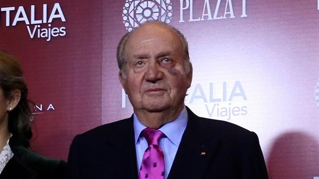 El leve hematoma del Rey Don Juan Carlos se debe a que los médicos le quitaron una mancha