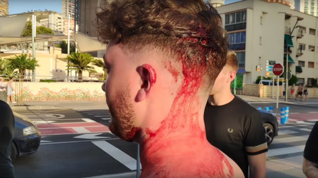 Unanimidad en Benidorm para exigir al Congreso de los Diputados que el juego de los trileros sea delito