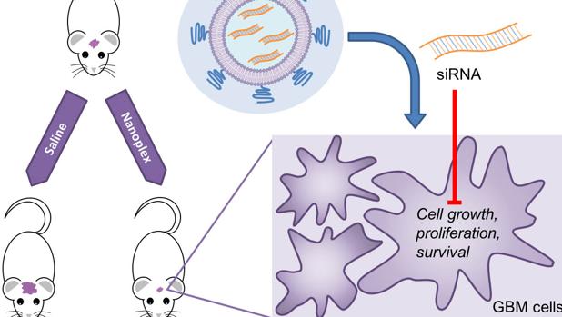 La UCLM coordina la investigación sobre un tumor cerebral muy agresivo