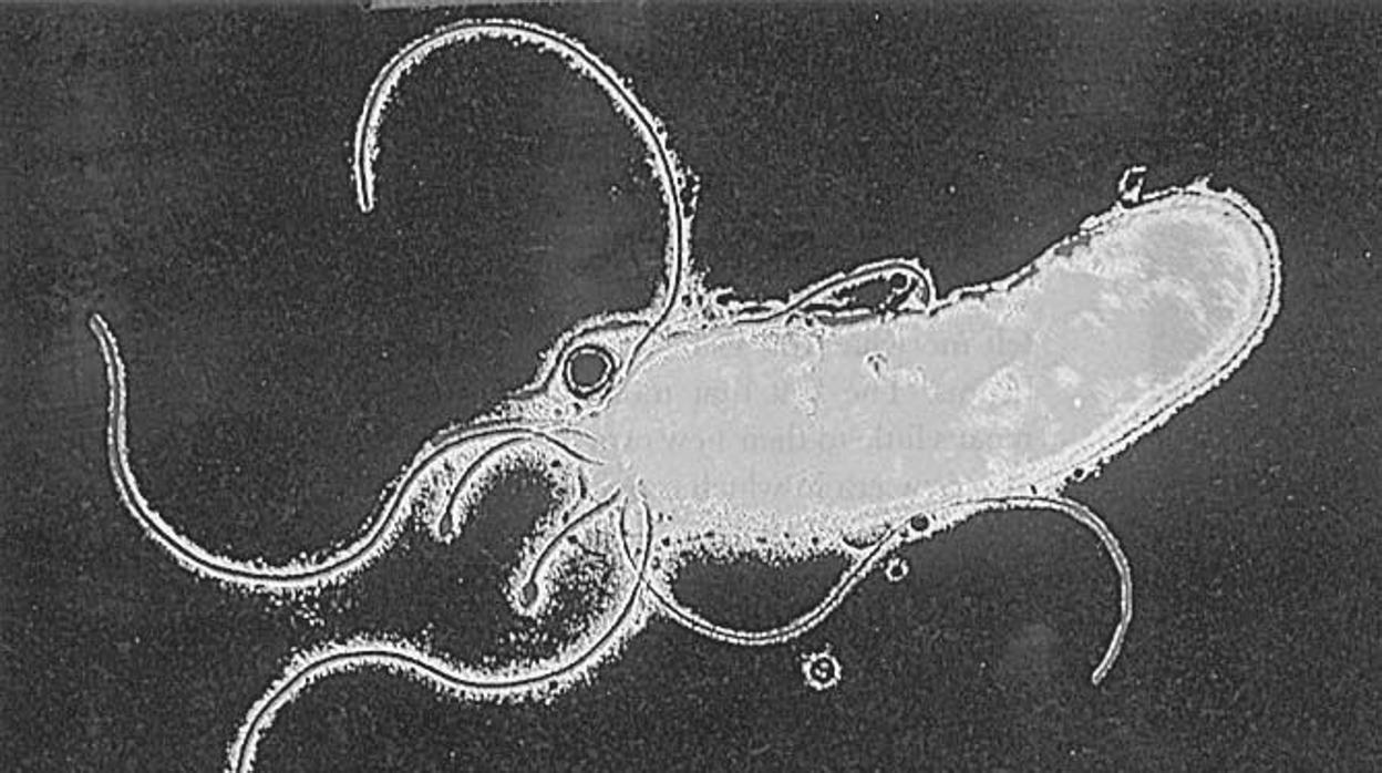 Imagen de la bacteria Helicobacter Pylori