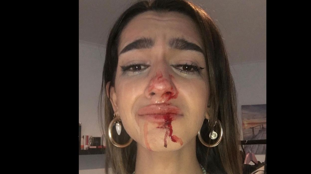 La chica agredida, en una imagen que colgó en las redes sociales