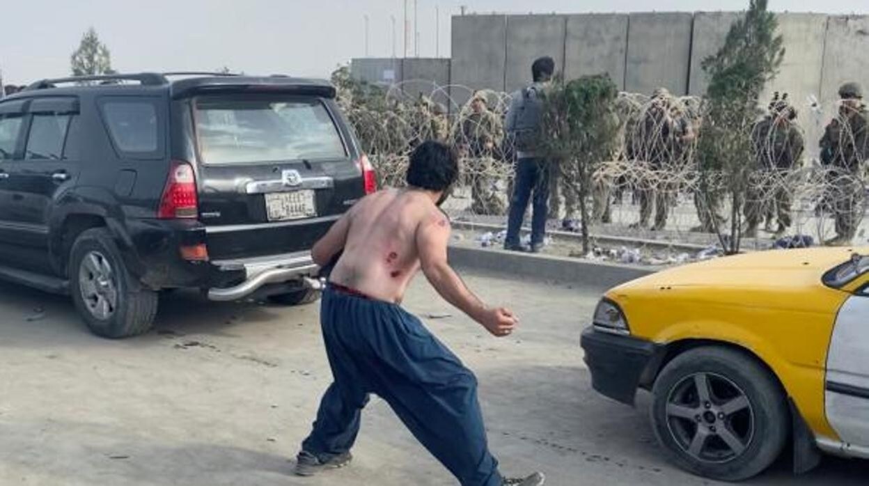 Un hombre herido en unas protestas en Kabul, Afganistán, en las inmediaciones del aeropureto