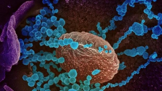 El color sí importa: un estudio concluye que las imágenes a color del coronavirus han hecho que se perciba como menos peligroso