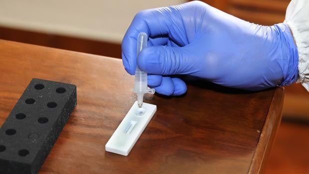 Sanidad empezará el 4 de enero a realizar test de antígenos con 12 unidades móviles