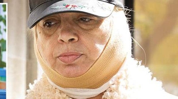 Carmen Borrego sufre complicaciones: «Se me ha descolgado el músculo de la papada»