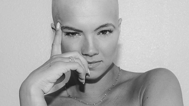 Christie Valdiserri, la modelo que normaliza la alopecia femenina encima de  las pasarelas