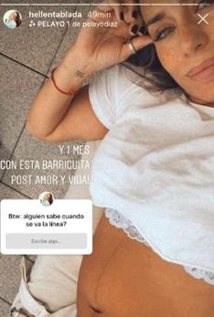 Elena Tablada, tras el parto: «Piernas amoratadas, puntos de la cesárea, ojeras y pechos doloridos»