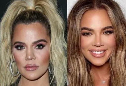 El antes y el después de Khloé Kardashian
