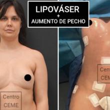 Miriam Sánchez, de la polémica venta de sus prótesis mamarias en Twitter a su operación estética integral