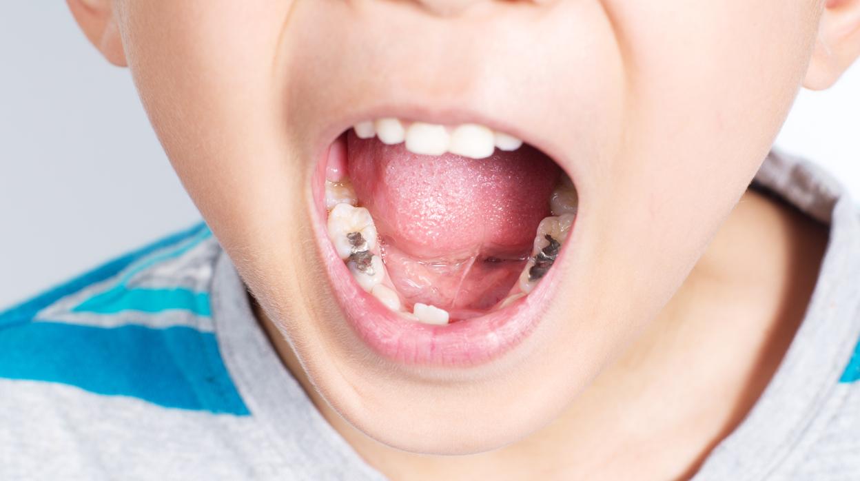 Estos son los minutos que debe durar el cepillado de tu hijo para evitar las caries