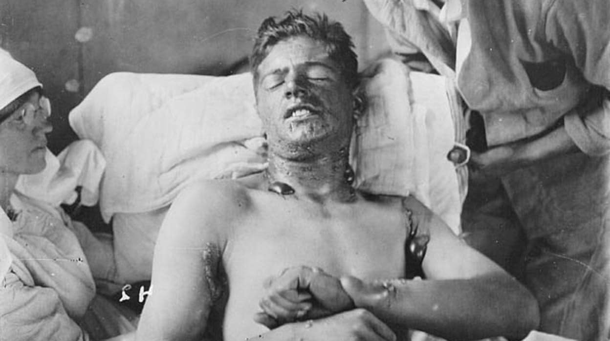 Un soldado de la Primera Guerra Mundial, recuperándose de las quemaduras por gas mostaza