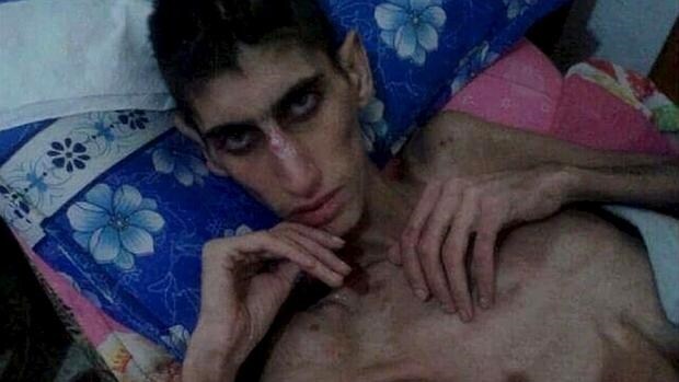 Un hombre demacrado en Madaya se ve en esta foto sin fecha tomada de los medios sociales