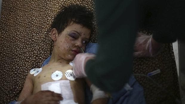 Un niño sirio descansa en la cama de un hospital tras resultar herido en un bombardeo sobre Douma, al noreste de Damasco
