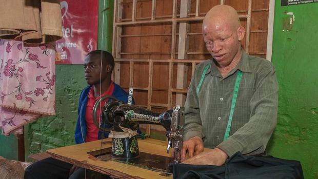 Un joven con albinismo trabaja con una máquina de coser en Malaui