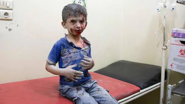 Un niño sirio en un hospital de Alepo