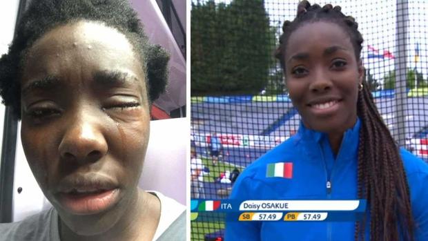 Los asaltos racistas en Italia llegan a una atleta de élite