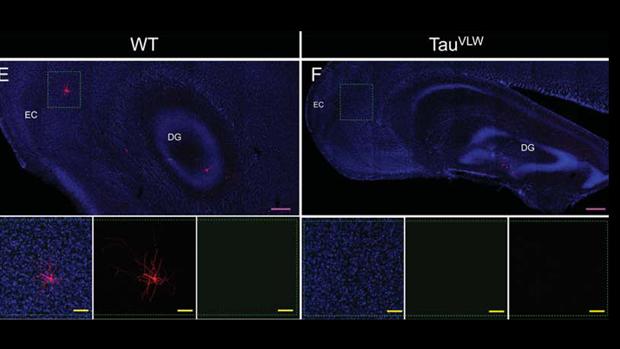 Investigadores españoles reparan neuronas en un modelo de ratón con demencia