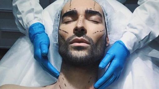 Personajes irreconocibles tras su paso por los quirófanos