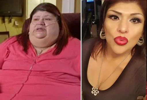El aspecto de Laura antes y después de pasar por Mi vida con 300 kilos