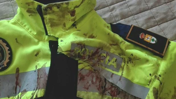 El uniforme de Juan Cadenas quedó lleno de sangre tras el ataque