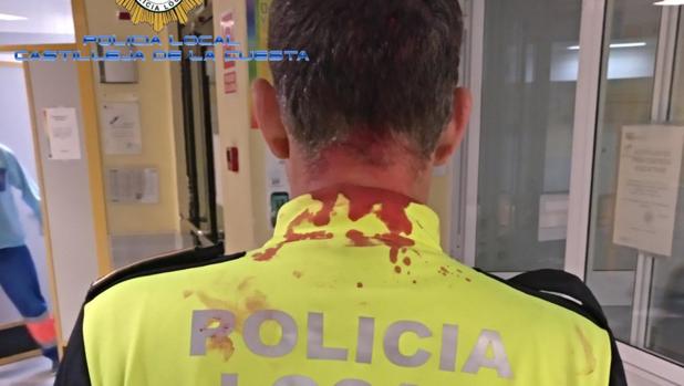 Detenido tras participar en una pelea y agredir a un policía local en Castilleja de la Cuesta