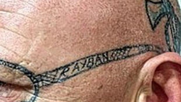 El hombre que se despertó con unas Ray-Ban tatuadas, consigue borrarlas