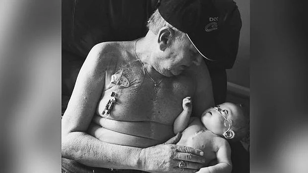 La emotiva historia de un abuelo y su nieto recién nacido que comparten cicatrices