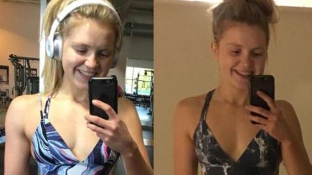 La fotografía de una joven en Instagram muestra el brutal cambio de nuestro cuerpo en un solo día