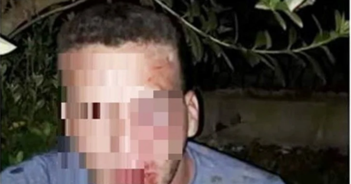 Imagen del joven tras haber sido agredido por la familia de la menor