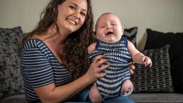 Su bebé nació sin piernas y un brazo, pero dice que no abortar fue la mejor decisión de su vida: «Es perfecto»