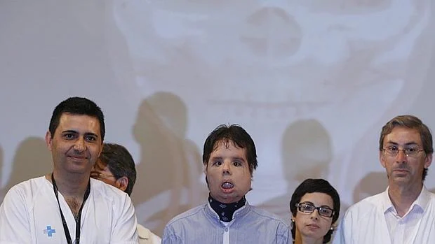 El primer trasplantado de cara total del mundo junto al cirujano Pere Barret del Hospital Vall D´Hebron de Barcelona