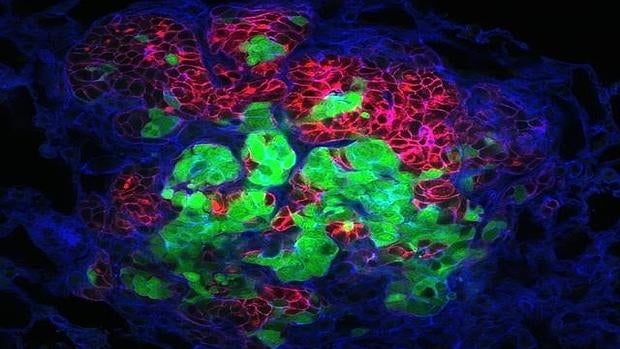 Metástasis en el pulmón a partir de células tumorales 'rojas' y 'verdes''