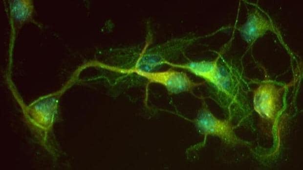 Sinapsis neuronales
